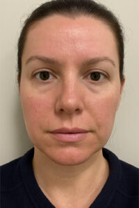 Vitamin A Review Derma-TX