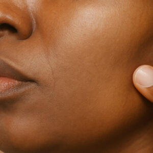 Vitamin A review Derma-TX - 3