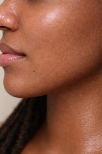 Resurfacing Trio photo review