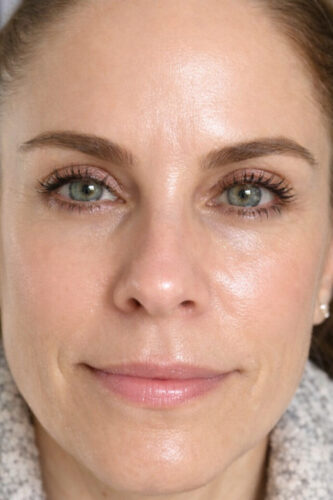 Click to view full screen Super Serum photo review