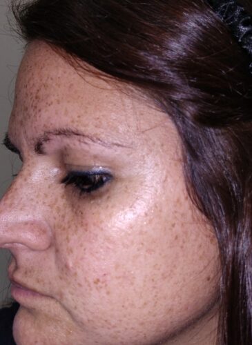 Retinyl Night Fix 5X photo review