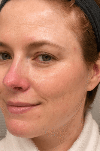 Retinyl Night Fix 5X photo review