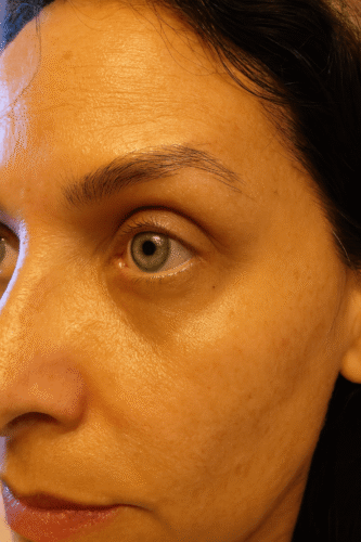 Retinyl Night Fix 5X photo review
