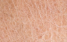 Dry Skin