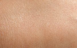 Normal Skin