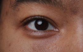 Not sure skin type (1)